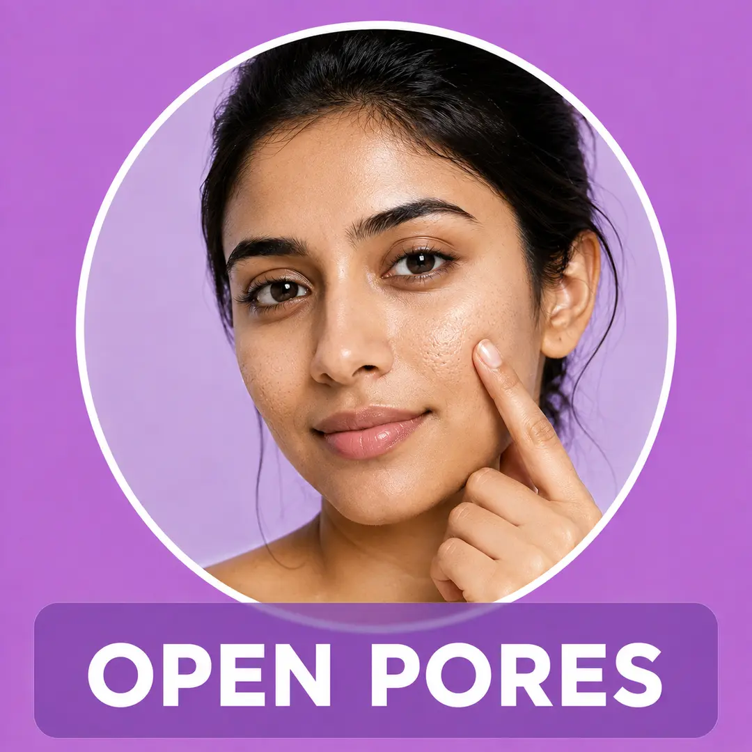 skin types