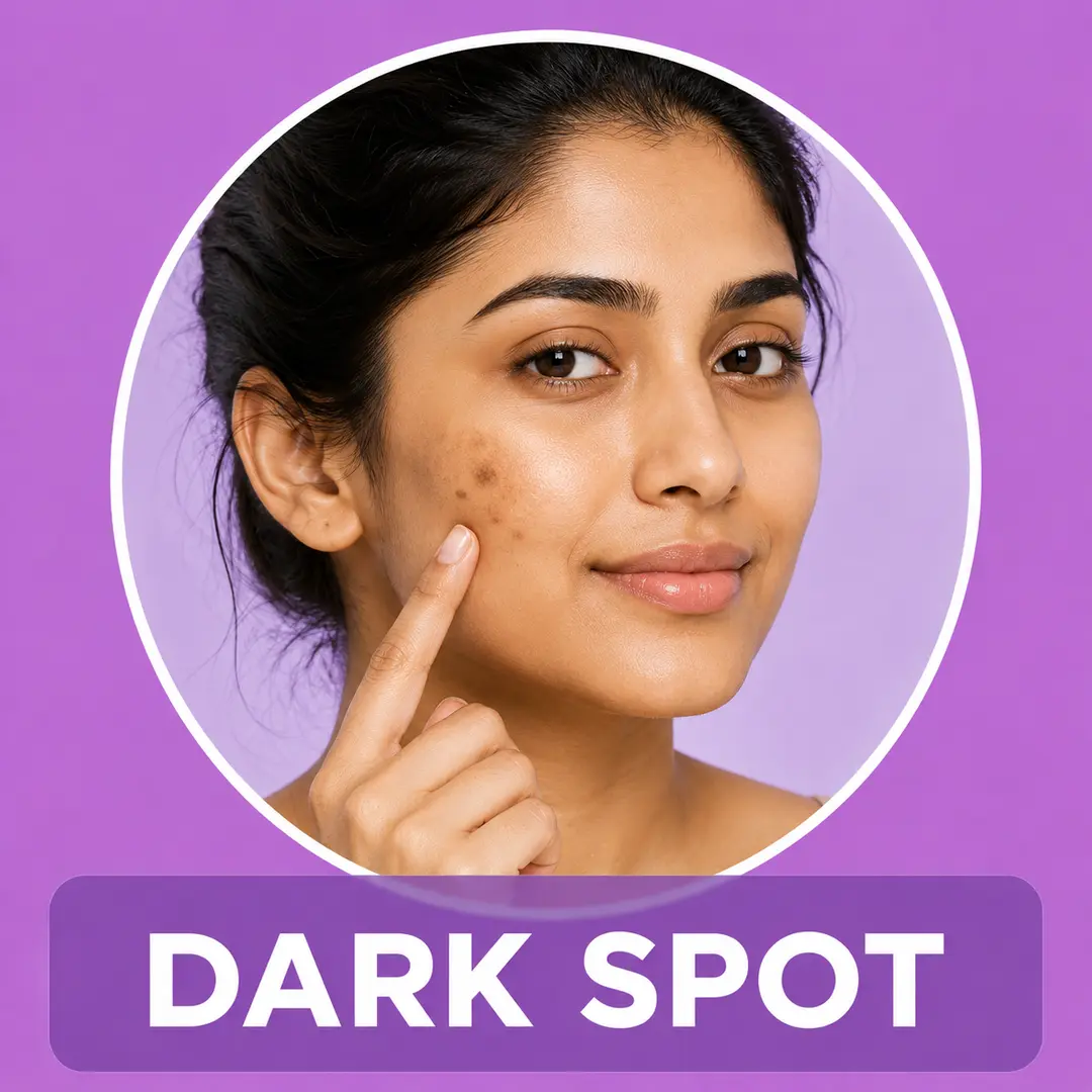 skin types
