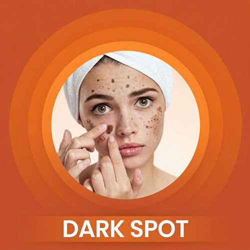 skin types