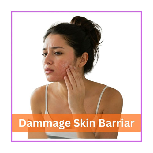 skin types