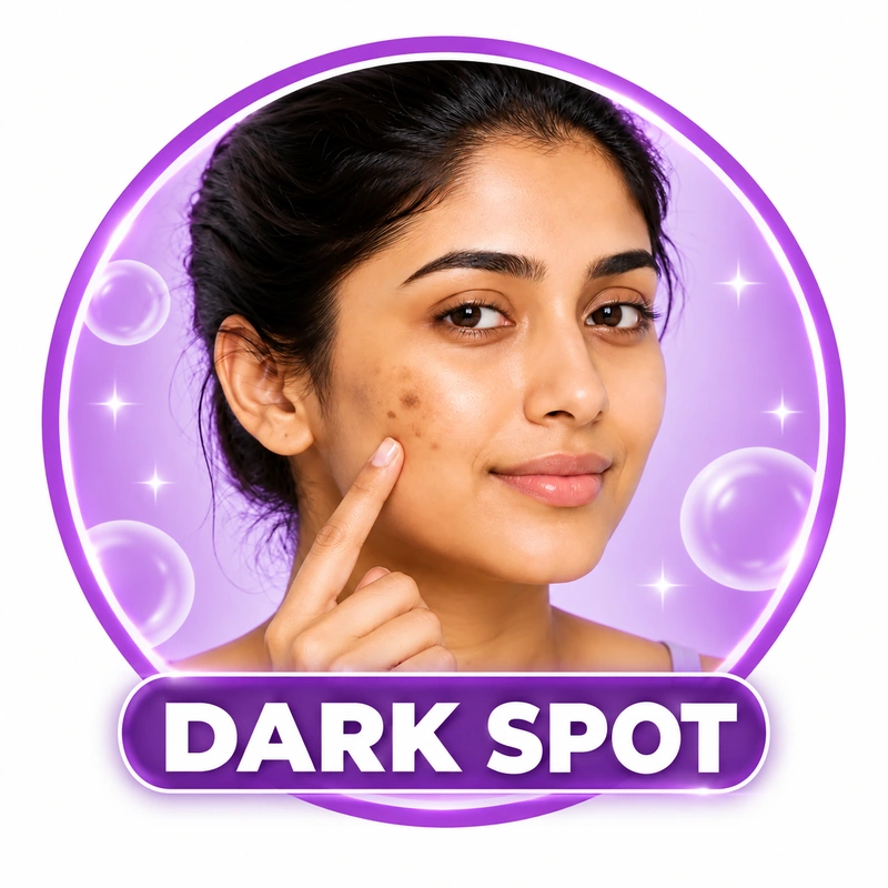 skin types