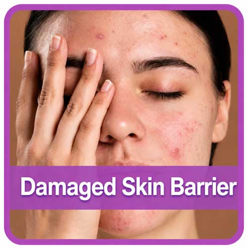 skin types