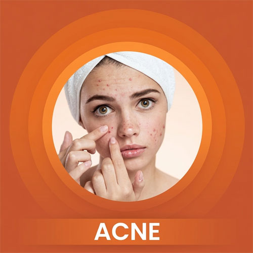 skin types