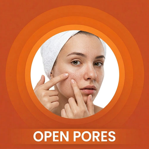 skin types